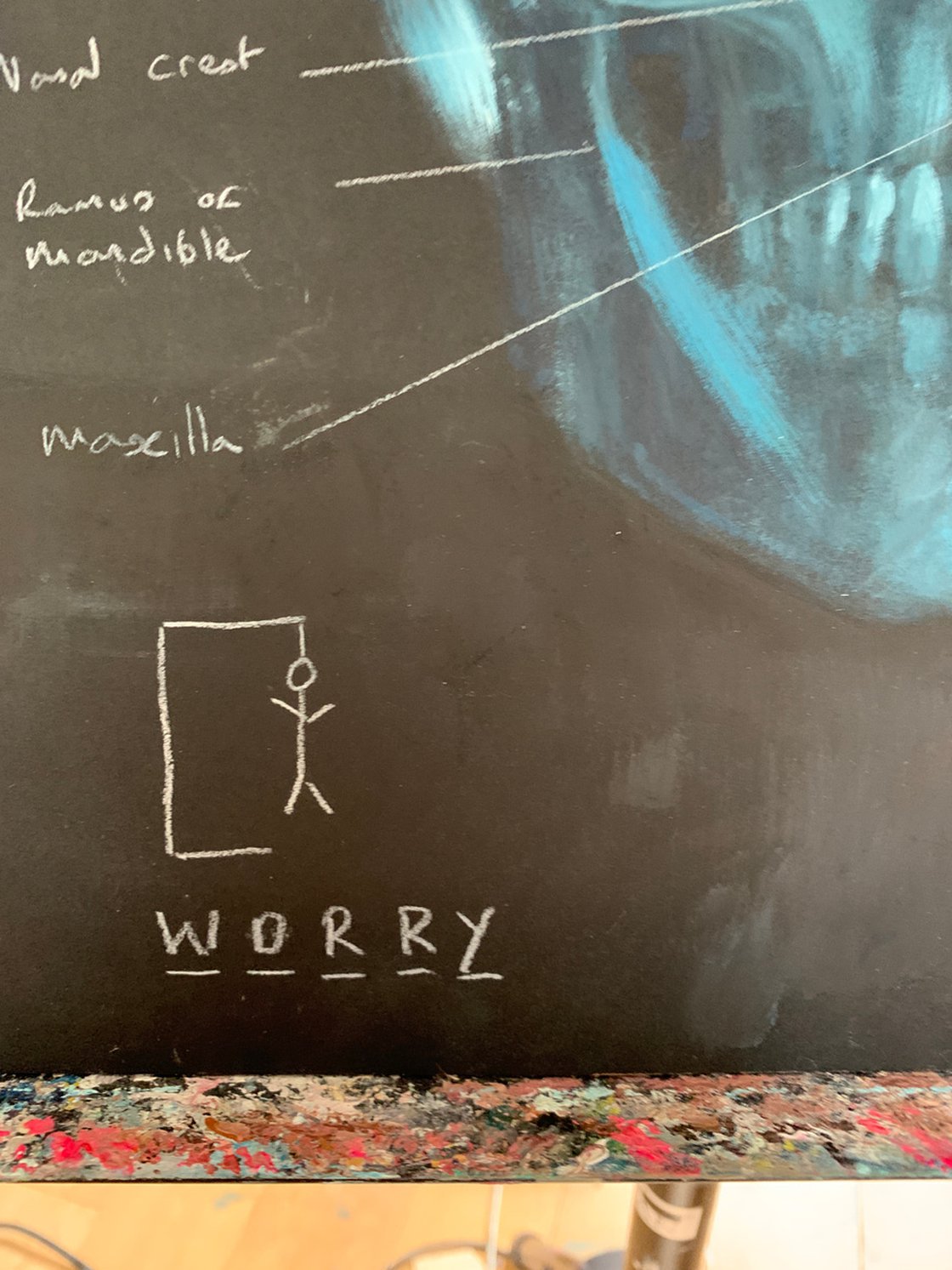 Thinking Too Much by Ryan Louder - Sold